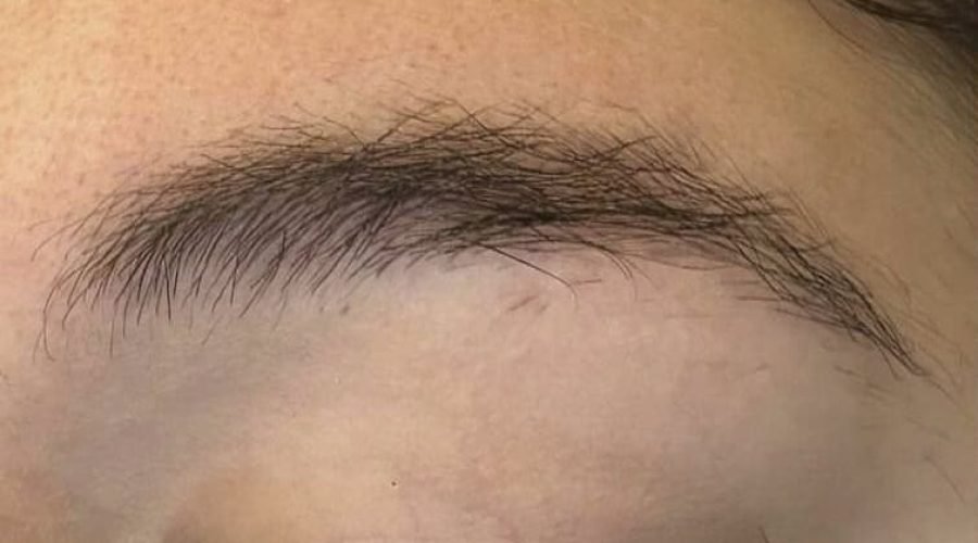 Before